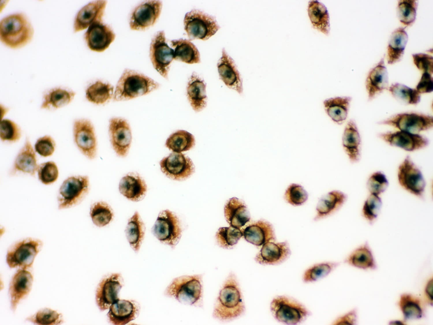 PRDX1 / Peroxiredoxin 1 Antibody (aa100-128)