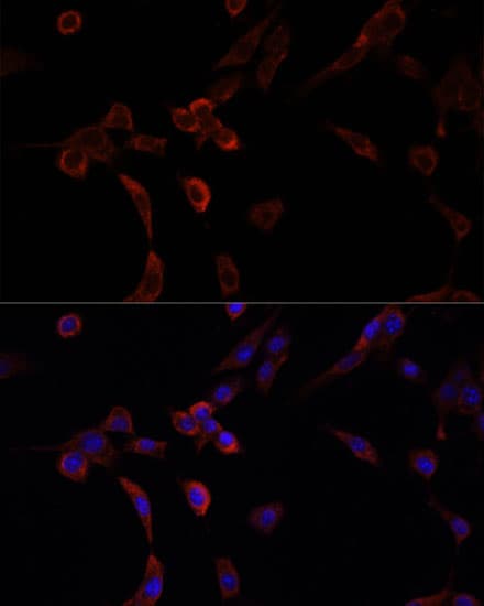 NRF1 / NRF-1 Antibody