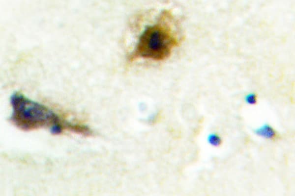 PFKL Antibody (Glu724)