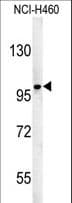 ST18 Antibody (aa339-367)