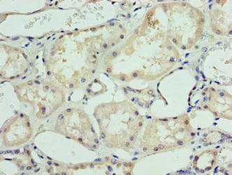 Polyclonal Rabbit anti-Human DHX9 Antibody (aa325-840)