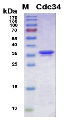 Human CDC34 Protein (Recombinant 6His, N-terminus)