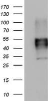 Monoclonal Mouse anti-Human MSR1 / CD204 Antibody (clone OTI5A6, aa197-451, WB)