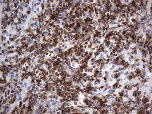 PRX-1 / PRRX1 Antibody (clone OTI1E10)