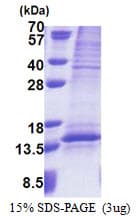 Human UQCRQ Protein (Recombinant His)