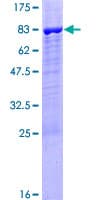 Human PPP2R5B Protein (Recombinant GST)