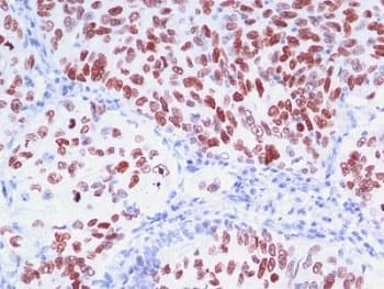 NKX2-1 / Thyroid-Specific TF Antibody (clone 8G7G3/1 + NX2.1/690, Ready-to-Use)
