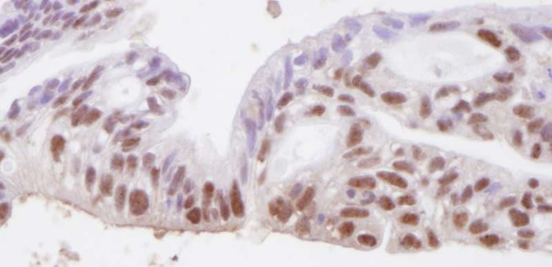 Polyclonal Rabbit anti-Human SMC3 / HCAP Antibody (aa1175-C-term, IHC)
