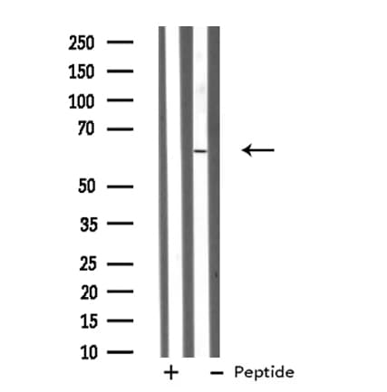 Polyclonal Rabbit anti-Human GRK4 Antibody (WB)
