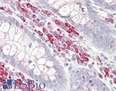 IHC-plus™ Polyclonal Rabbit anti-Human SEPT6 / Septin 6 Antibody (aa208-257, IHC, WB)