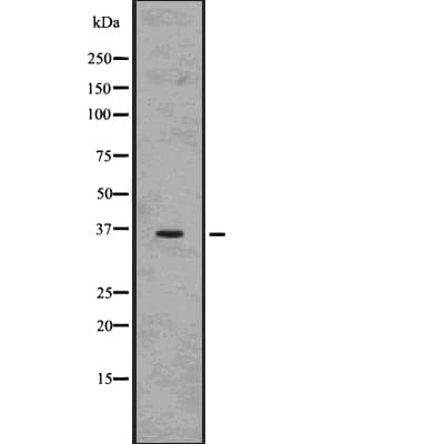 CD68 Antibody