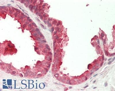 IHC-plus™ Polyclonal Rabbit anti-Human RAD23A / HHR23A Antibody (aa200-250, IHC, WB)