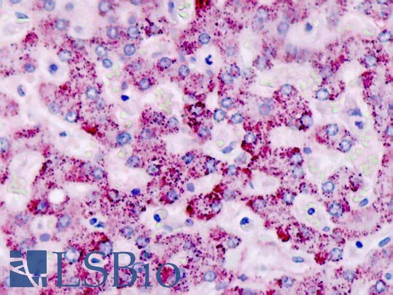 IHC-plus™ CAPNS2 Antibody (aa55-83)