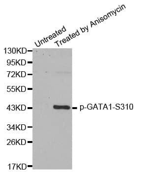 Polyclonal Rabbit anti-Human GATA1 Antibody (phospho-Ser310, IF, WB)