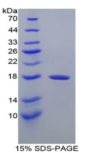 Dog TTR / Transthyretin Protein (Recombinant His, N-Terminal)