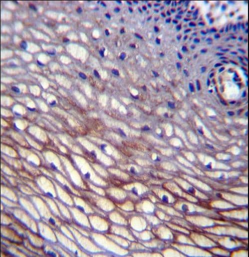 Polyclonal Rabbit anti-Human SKA2 Antibody (aa9-37, IHC, WB)