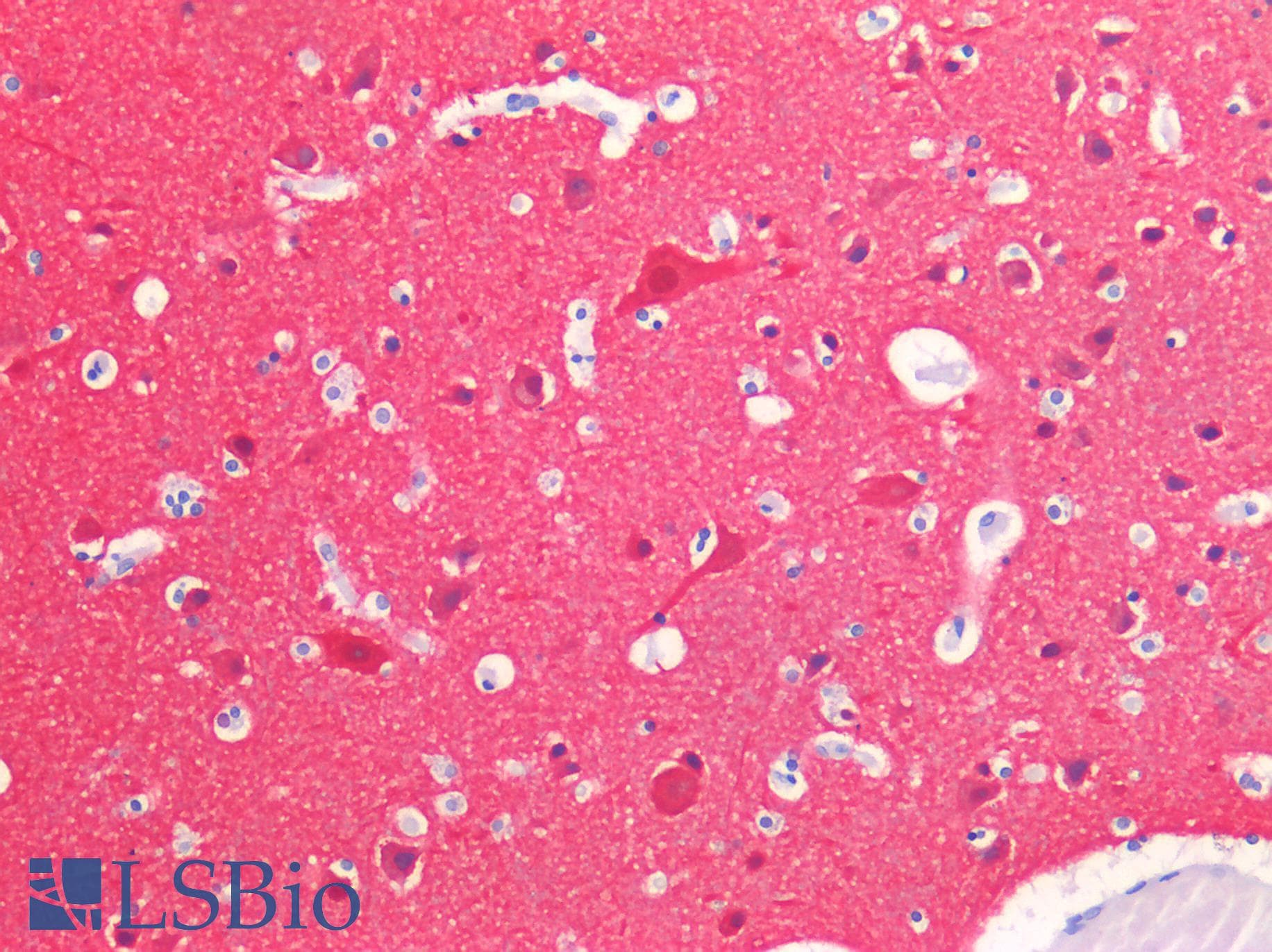 IHC-plus™ TUBB3 / Tubulin Beta 3 Antibody