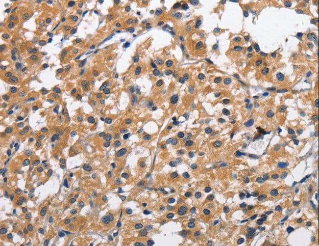 Polyclonal Rabbit anti-Human CLEC2D / OCIL / LLT1 Antibody (IHC)