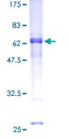 Human REM1 / REM-1 Protein (Recombinant GST)