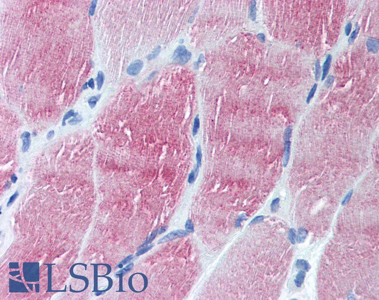 IHC-plus™ ARL6 Antibody (N-Terminus)