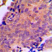 SLC25A6 / ANT3 Antibody (Internal)