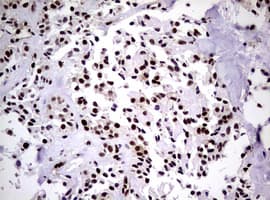 Monoclonal Mouse anti-Human NBN / Nibrin Antibody (clone OTI8E7, IHC, WB)