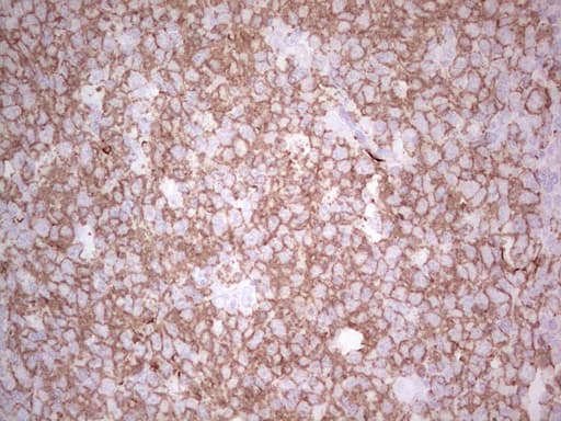 Monoclonal Mouse anti-Human TET3 Antibody (clone OTI4B7, aa241-568, IHC, WB)