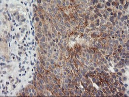 TIMP2 Antibody (clone OTI2G7)