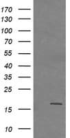 Monoclonal Mouse anti-Human CTAG1B / NY-ESO-1 Antibody (clone OTI1C4, IHC, IF, WB)