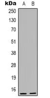 NUTF2 / PP15 Antibody (Internal)