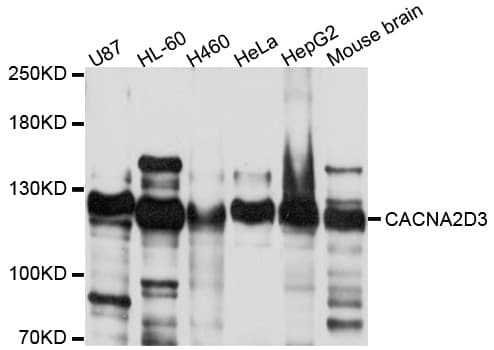 CACNA2D3 / Alpha-2/Delta-3 Antibody