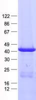 Human KRT19 / CK19 / Cytokeratin 19 Protein (Recombinant His, N-Terminal)