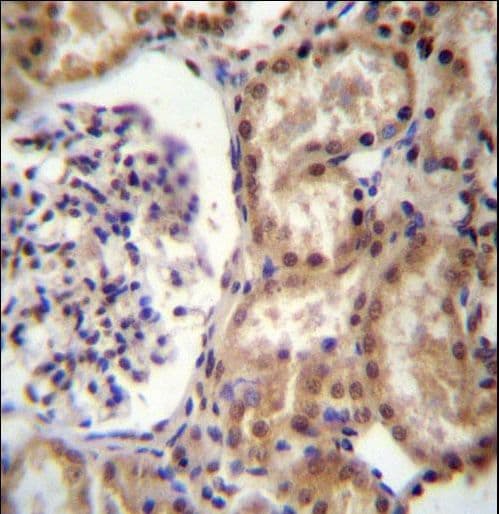 Polyclonal Rabbit anti-Human RNF43 Antibody (aa543-572, IHC, WB)