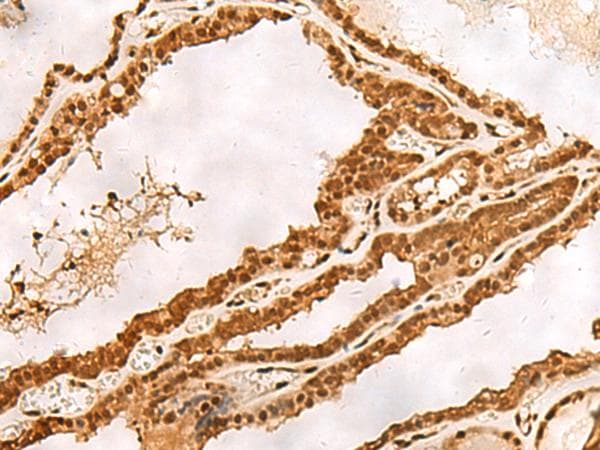 Polyclonal Rabbit anti-Human PSMA3 Antibody (IHC, WB)