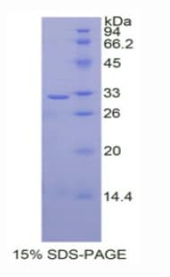 Human UGT1A / UGT1A1 Protein (Recombinant His, N-Terminal)