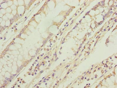 TMEM71 Antibody