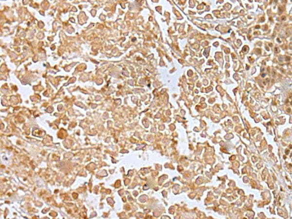 Polyclonal Rabbit anti-Human RILPL2 Antibody (IHC, WB)