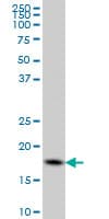 Monoclonal Mouse anti-Human CFL1 / Cofilin Antibody (clone 1A1, IHC, IF, WB)