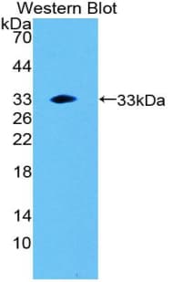 LIPG / Endothelial Lipase Antibody (aa203-471)