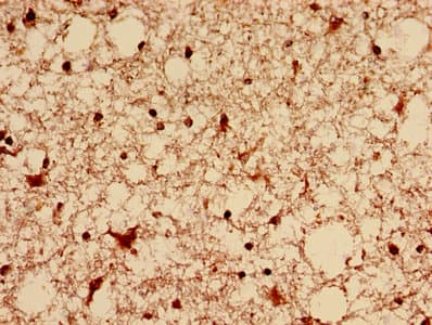 DNM1L / DRP1 Antibody