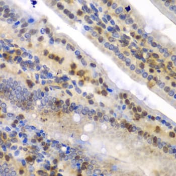 SYNCRIP / HnRNP Q Antibody
