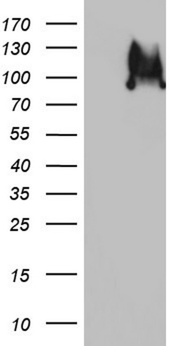R1 / RRM1 Antibody (aa541-792, clone OTI3G5, Carrier-free)