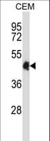 Polyclonal Rabbit anti-Human CREB5 Antibody (aa1-30, WB)