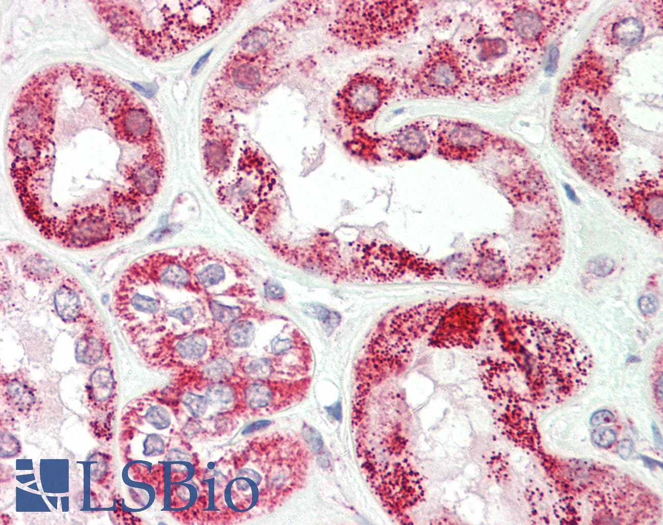 Polyclonal Rabbit anti-Human VARS / ValRS Antibody (aa576-625, IHC, WB)