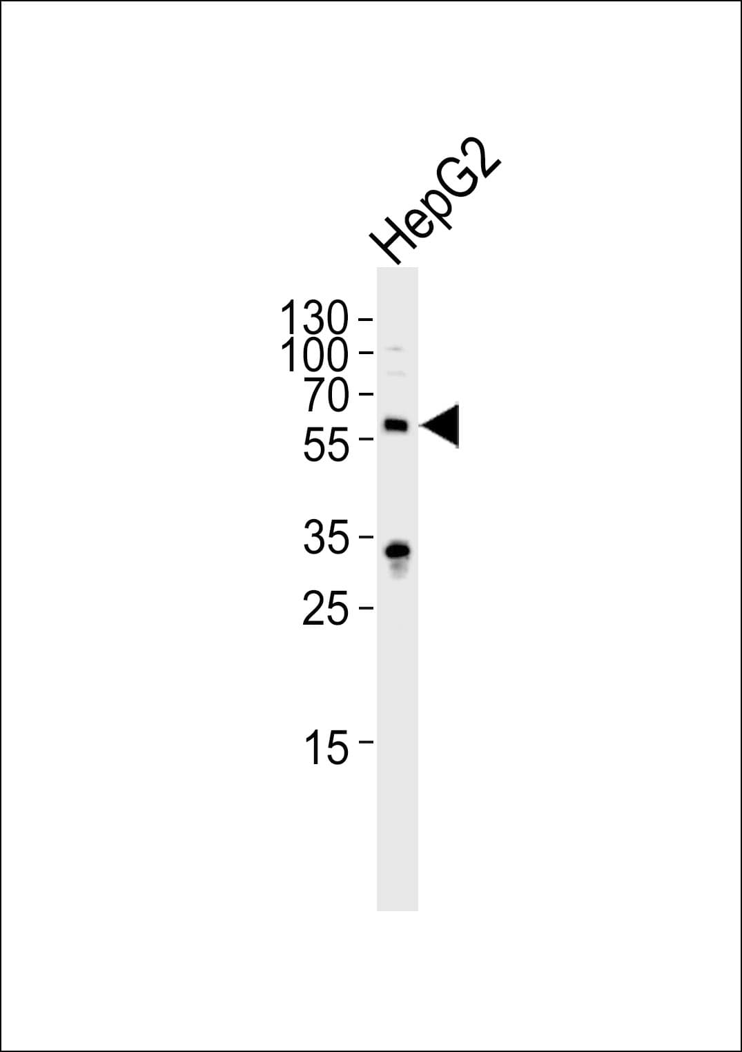IHC-plus™ Polyclonal Rabbit anti-Human IL1R1 Antibody (aa474-503, IHC, WB)