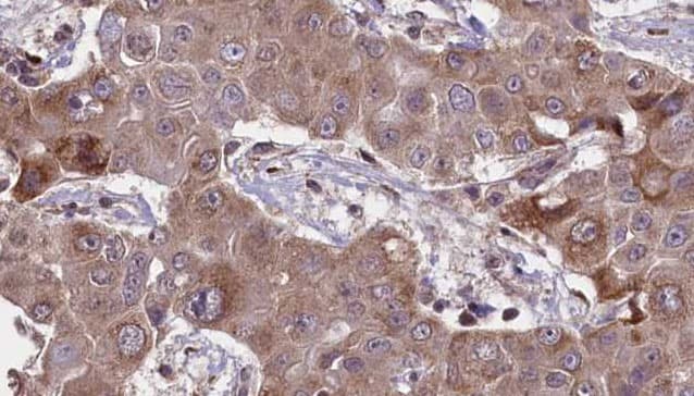 PDGFRA / PDGFR Alpha Antibody