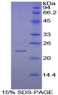 Human KLRC2 / NKG2C / CD159c Protein (Recombinant His-T7)