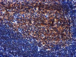 PIH1D2 Antibody (clone OTI4A10)
