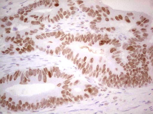 Monoclonal Mouse anti-Human RB1 / Retinoblastoma / RB Antibody (clone OTI3F11, aa309-590, IHC, WB)