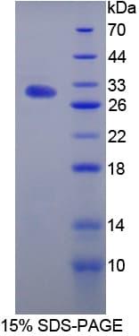 Rat IL17RA Protein (Recombinant His-T7)
